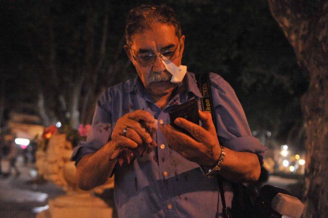 José Granata, tras ser herido en la plaza.