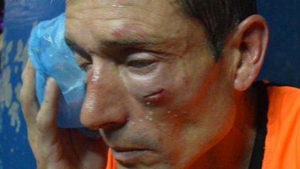 El árbitro fue brutalmente agredido por los hinchas de Sarmiento de Ayacucho.&nbsp;