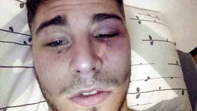 Las lesiones en el rostro de Mateo.