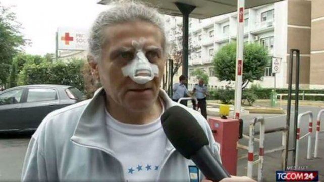 Girotto debió ser hospitalizado tras el ataque.
